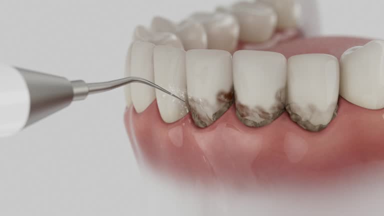 Trusted Invisalign Clear Aligners service in Four Corners, MD - Dentist Open Now